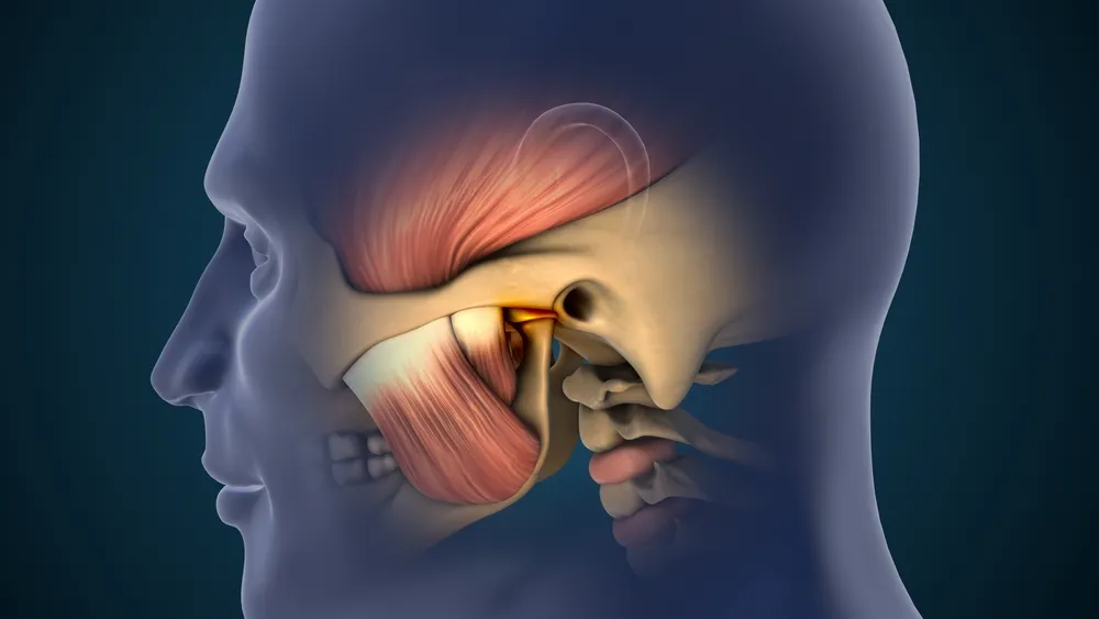 TMJ Disorder Management
